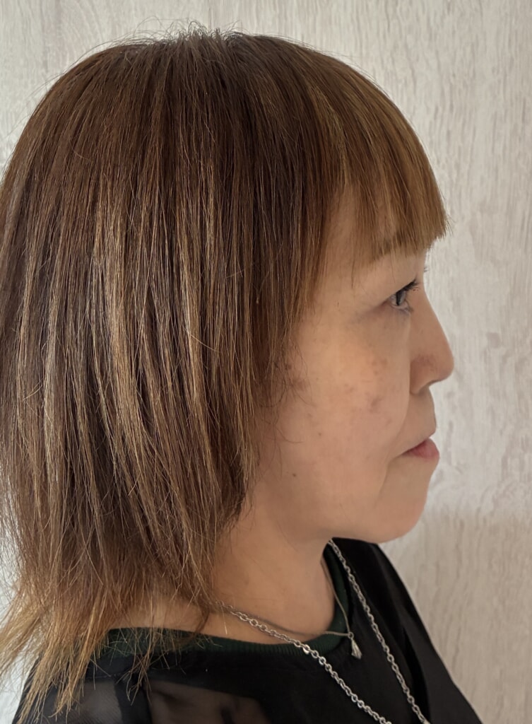 再生美容エステ 再生美容エステ